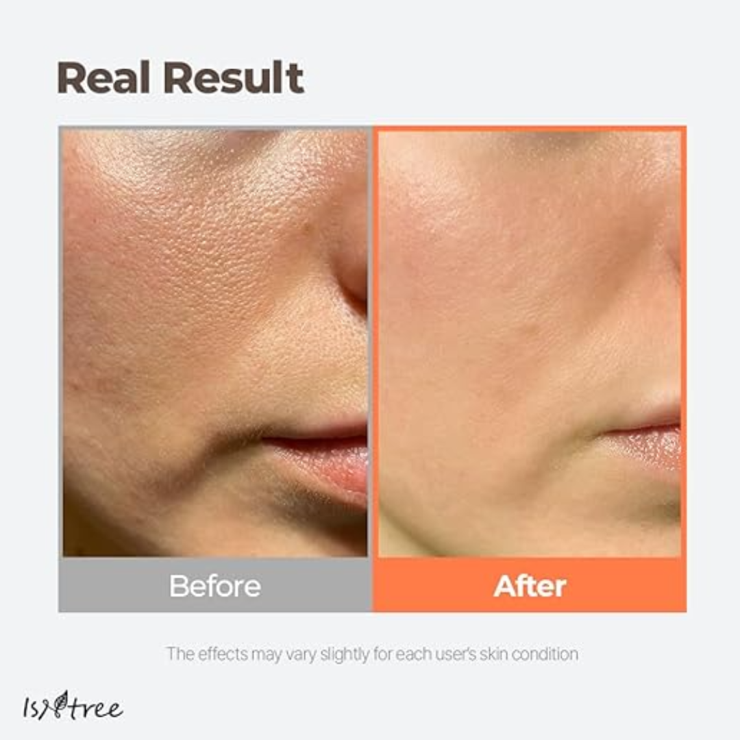 Isntree GREEN TEA FRESH TONER 200ml 25% off (Inclusive of all taxes)