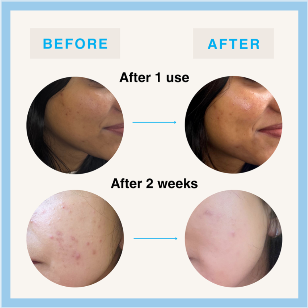 ISLAND Morning Dew Korean Rice Water Mositurizer with SPF15 35% off (Inclusive of all taxes)
